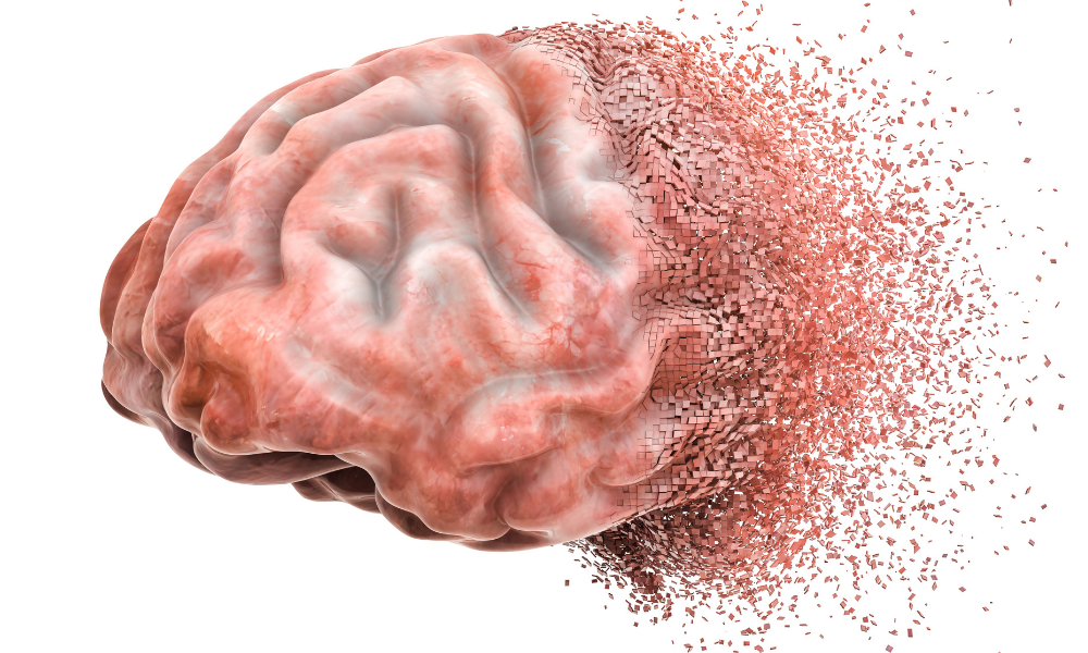 Kosttilskud og Alzheimers: Hvad viser forskningen egentlig?