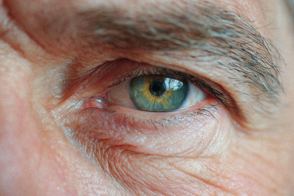 Tør AMD: Kosttilskud viser lovende effekt