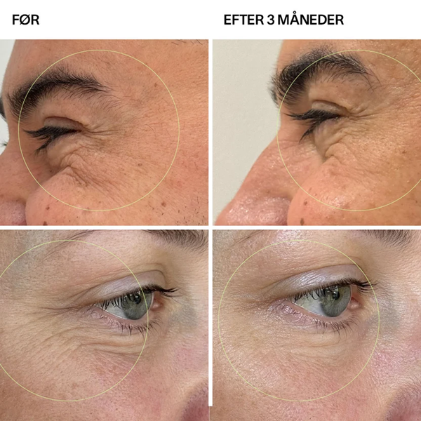 Kollagen Tripeptides Type I & III <500 Da + ultraHA® produktbillede
