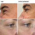 Kollagen Tripeptides Type I & III <500 Da + ultraHA®